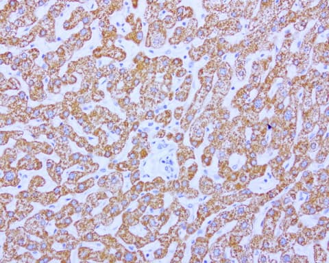 ABAT Antibody (aa29-323, clone UMAB180, Carrier-free)