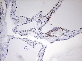 CD5 Antibody (clone OTI10F4)