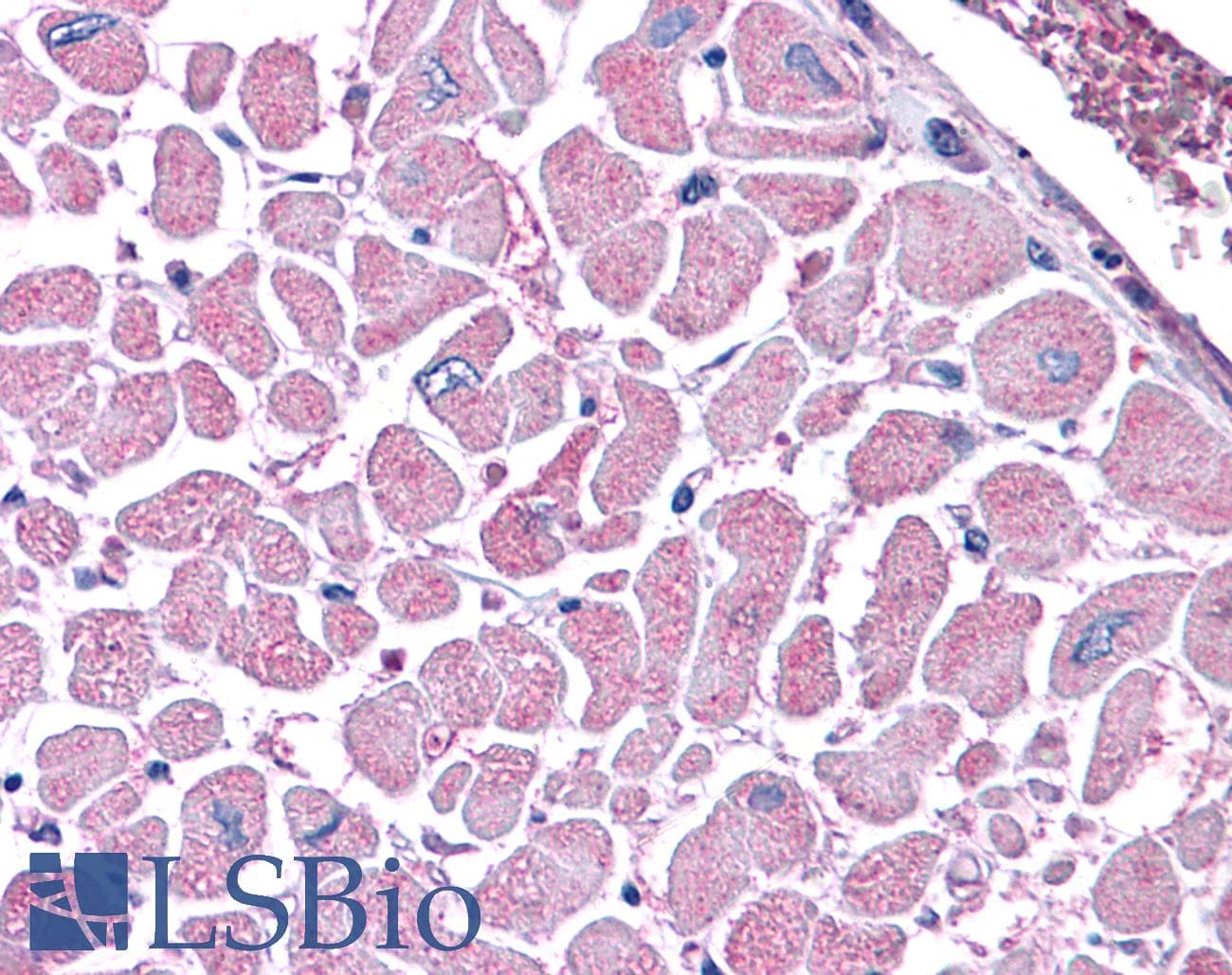 IHC-plus™ Kinesin Heavy Chain / KIF5B Antibody (clone KN-03)