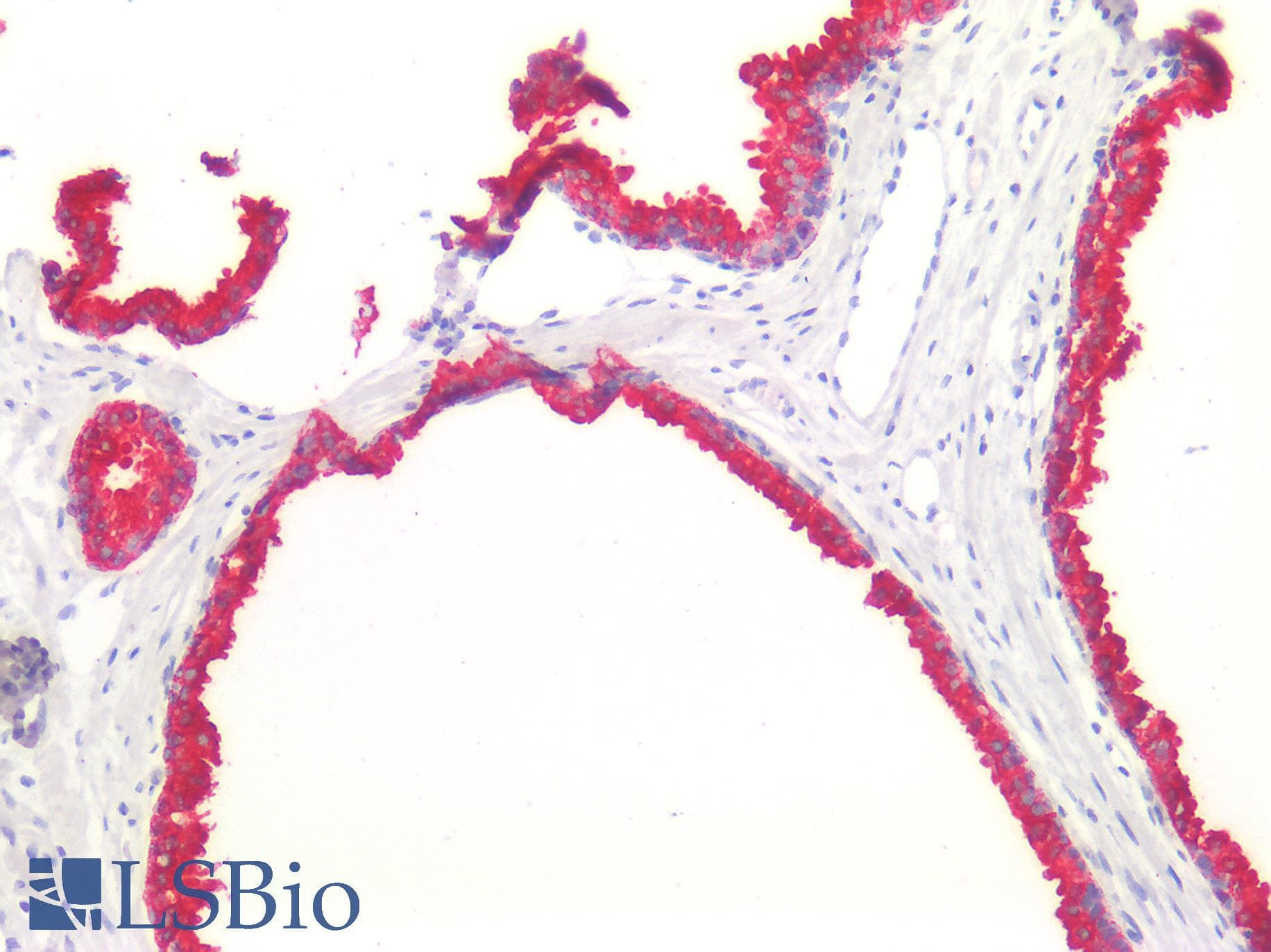 PathPlus™ KRT5 / CK5 / Cytokeratin 5 Antibody