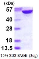Human ADSL / Adenylosuccinate Lyase Protein (Recombinant His)