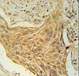 TRAG3 / CSAG2 Antibody (aa1-30)