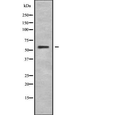 Polyclonal Rabbit anti-Human CRF2-12 / IL28RA Antibody (WB)