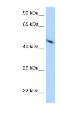 PVR / CD155 Antibody (aa78-127)