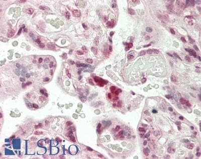 IHC-plus™ Polyclonal Rabbit anti-Human LIN28A / LIN28 Antibody (IHC, IF, WB)