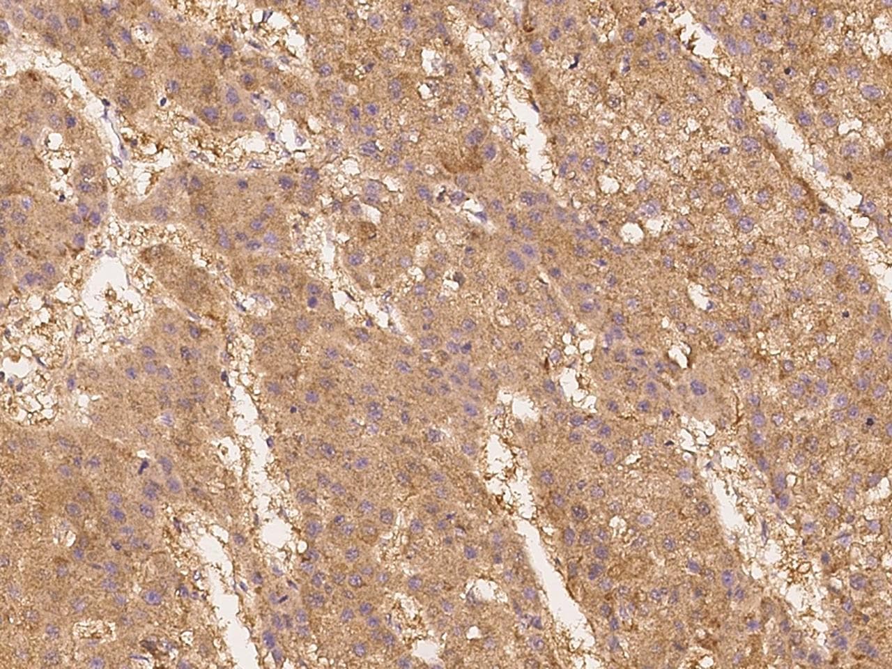 IL13RA1 / IL13R Alpha 1 Antibody