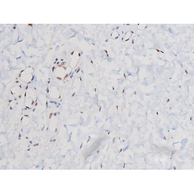 STAT3 Antibody (phospho-Ser727)