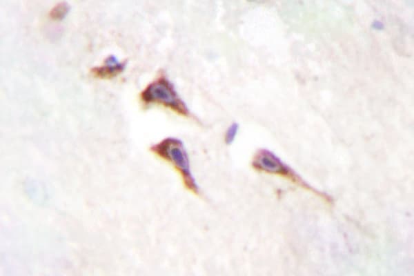 MTOR Antibody (Ser2442)