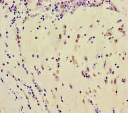 TDRD3 Antibody