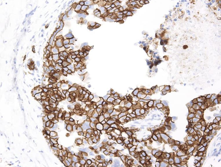CDH1 / E Cadherin Antibody (clone AHC0103)