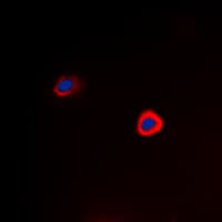 PAK1 Antibody (phospho-Thr212)