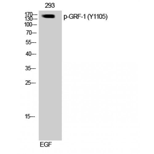 ARHGAP35 / GRLF1 Antibody (1040-1120 aa)