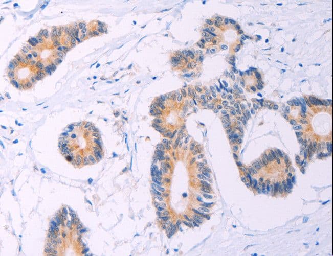ADCY5 / Adenylate Cyclase 5 Antibody