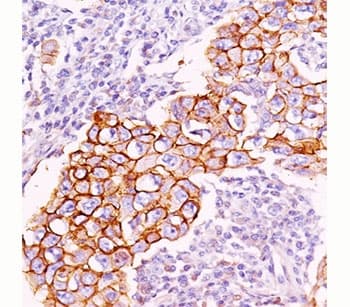 Phosphotyrosine Antibody (clone PY20, Azide-free, BSA-free)