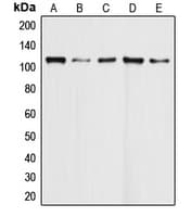 Polyclonal Rabbit anti-Human DAXX Antibody (Internal, IHC, IF, WB)