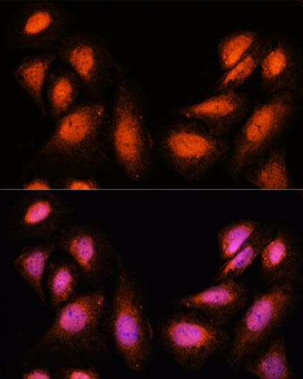 SUPT6H / SPT6 Antibody
