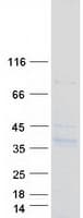 Human SYNPR / Synaptoporin Protein (Recombinant Myc-DDK (Flag))