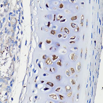 COMP / THBS5 Antibody