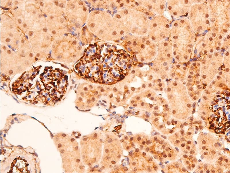 TP53 / p53 Antibody (phospho-Ser392)