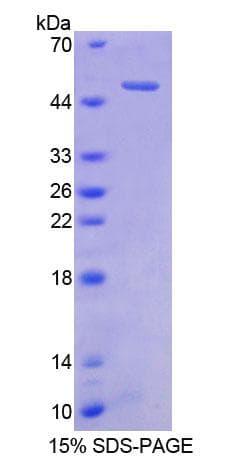 Human CBLN1 / Cerebellin 1 Protein (Recombinant His-GST)