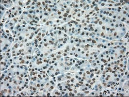 TYRO3 Antibody (clone OTI4C8)