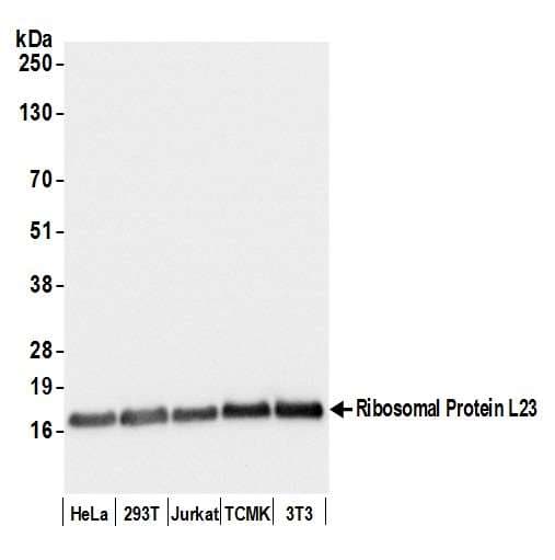 RPL23 / Ribosomal Protein L23 Antibody (aa90-140)