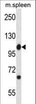 Polyclonal Rabbit anti-Human ABL1 / c-ABL Antibody (aa613-641, IHC, WB)