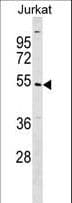 UBE2Q1 Antibody (aa78-104)
