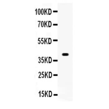 WNT1 Antibody (aa45-74)