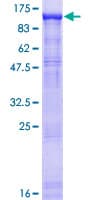 Human DDX20 / GEMIN3 Protein (Recombinant GST)