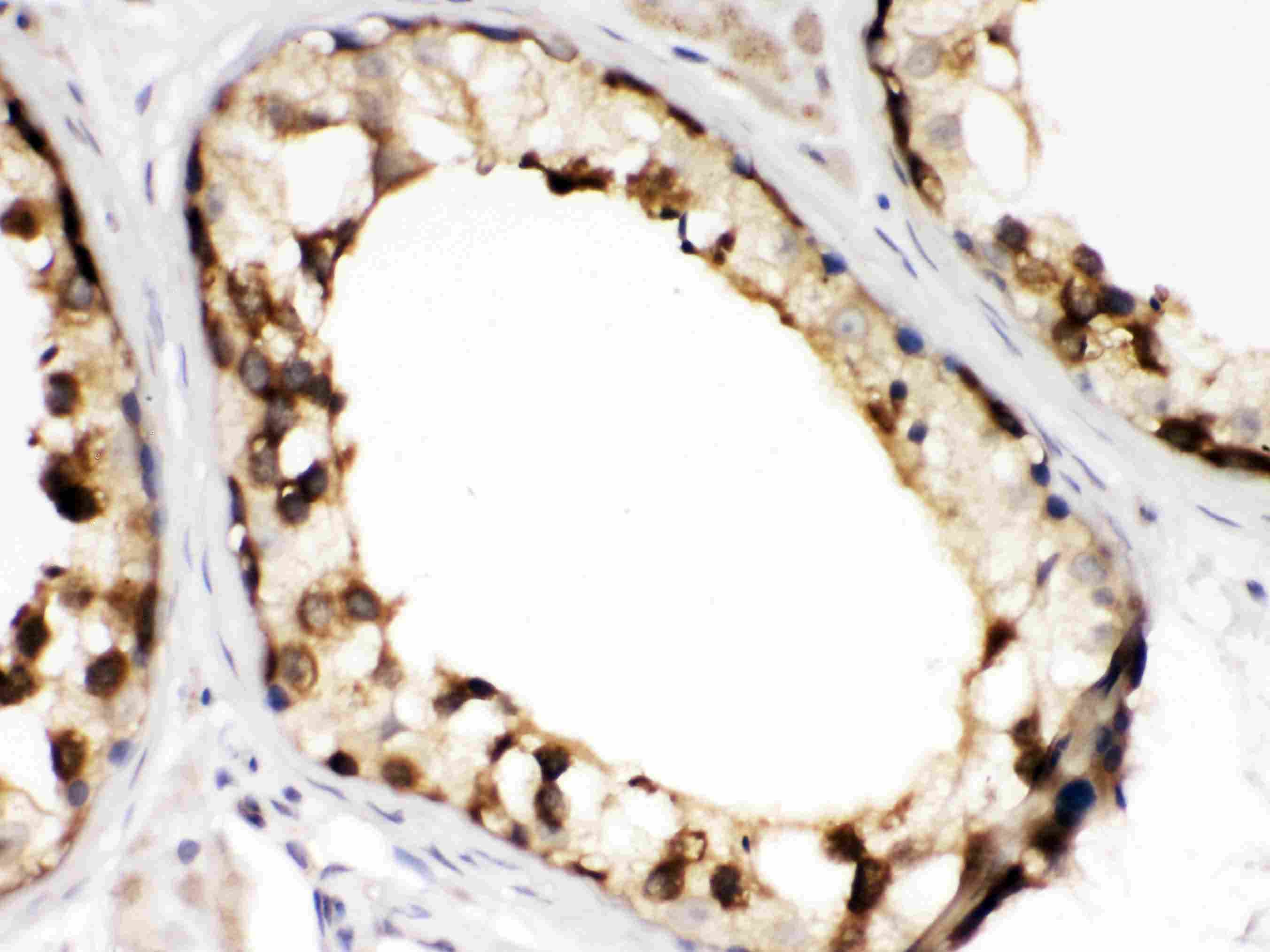 CCT2 / CCT Beta Antibody