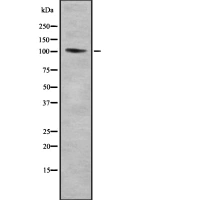 IHC-plus™ TTF1 / Txn Termination Factor Antibody