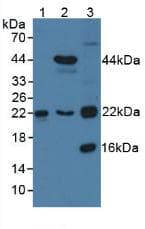 TAGLN2 / Transgelin 2 Antibody (aa2-199, APC)
