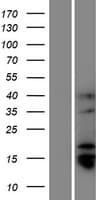 TMPRSS11BNL Protein (Over-Expression Lysate Myc-DDK (Flag))