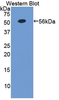 EPOR / EPO Receptor Antibody (aa33-210, APC)