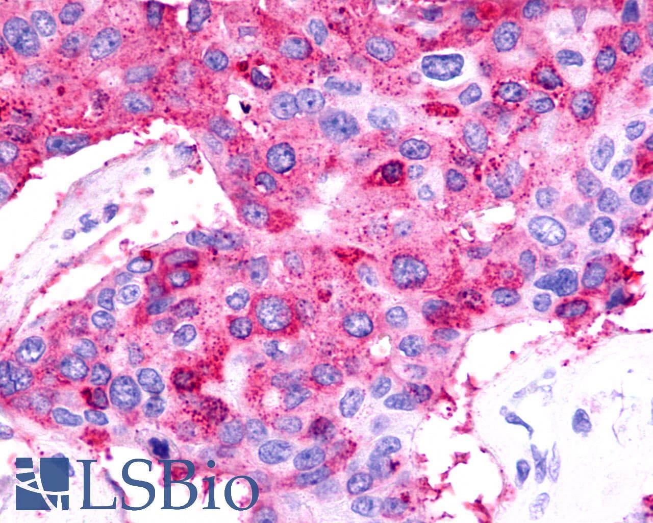 IHC-plus™ Polyclonal Rabbit anti-Human TPRA1 / GPR175 Antibody (Cytoplasmic Domain, IHC)