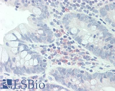 IHC-plus™ Polyclonal Rabbit anti-Human BTLA / CD272 Antibody (IHC)