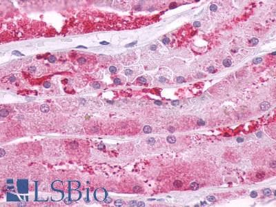 IHC-plus™ PTHR / PTHR1 Antibody (N-Terminus)