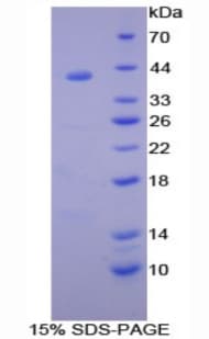 Rat SDC1 / Syndecan 1 / CD138 Protein (Recombinant His-GST)