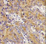 MYO1C Antibody (aa911-940)