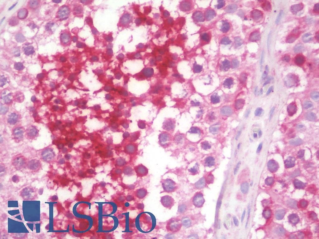 IHC-plus™ GLIPR1L1 Antibody