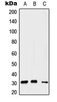 SIP1 Antibody (Internal)