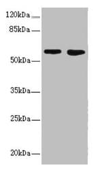 Polyclonal Rabbit anti-Human FLVCR2 Antibody (IHC, WB)