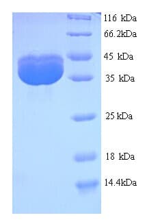 JC Polyomavirus JC Polyoma Virus VP2 Protein (Recombinant His)