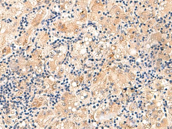 Polyclonal Rabbit anti-Human MRPL16 Antibody (IHC)