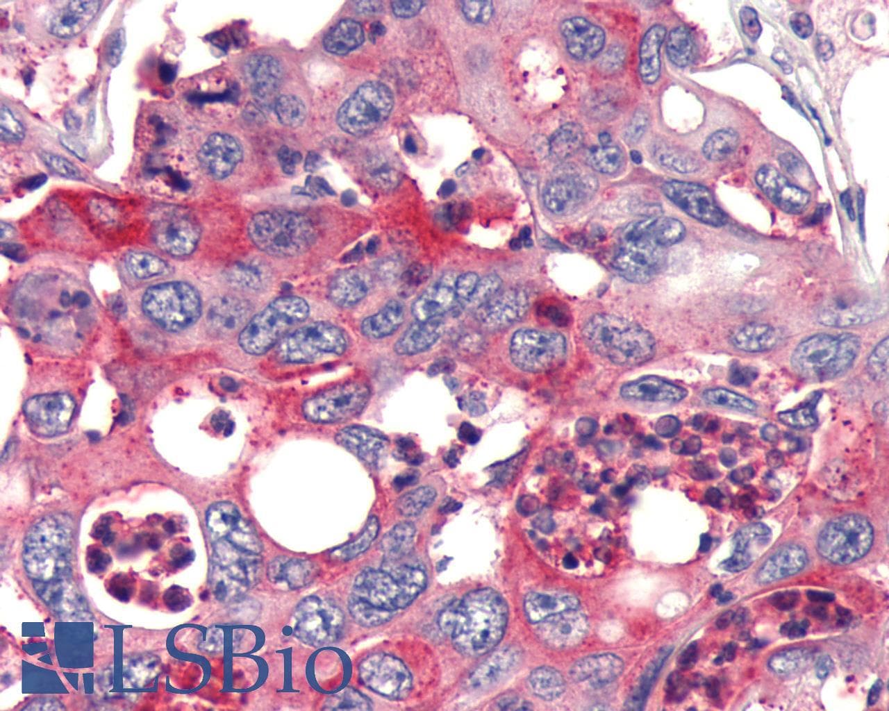 PathPlus™ FZD4 / Frizzled 4 Antibody (C-Terminus)