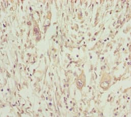 Polyclonal Rabbit anti-Human NPTN / SDR1 Antibody (IHC)