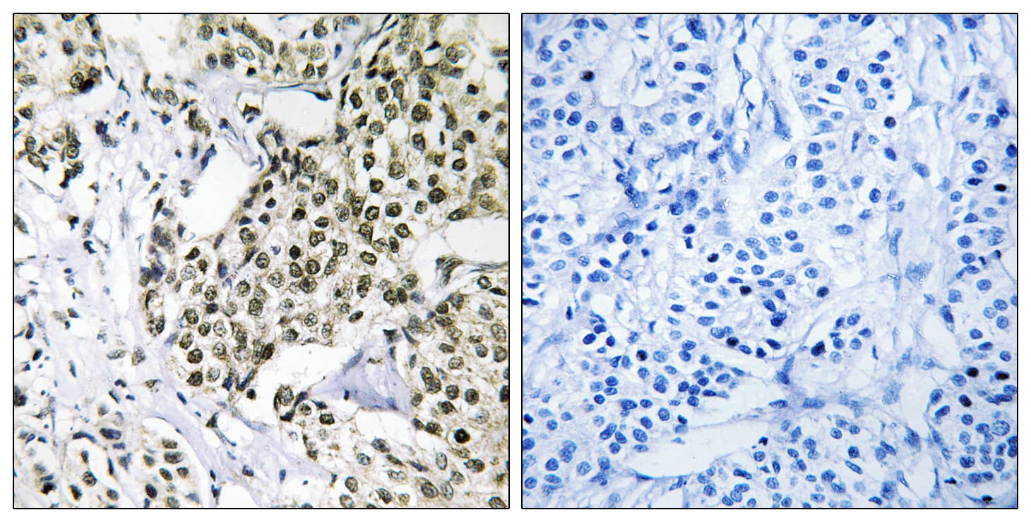 CAGE1 / Cancer Antigen 1 Antibody (aa711-760)