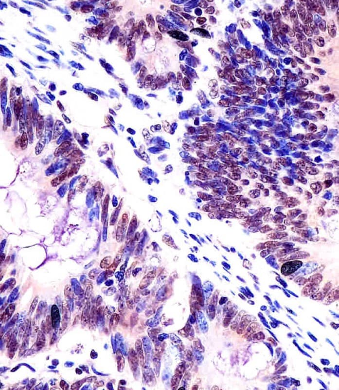 KHDRBS1 / SAM68 Antibody (aa259-291)