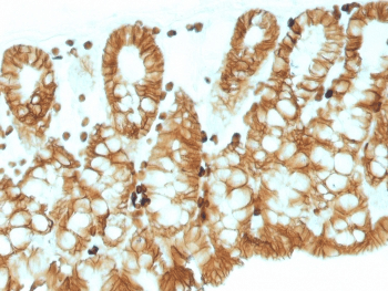 EPCAM Antibody (Cytoplasmic Domain, clone EGP40/1110, Ready-to-Use)